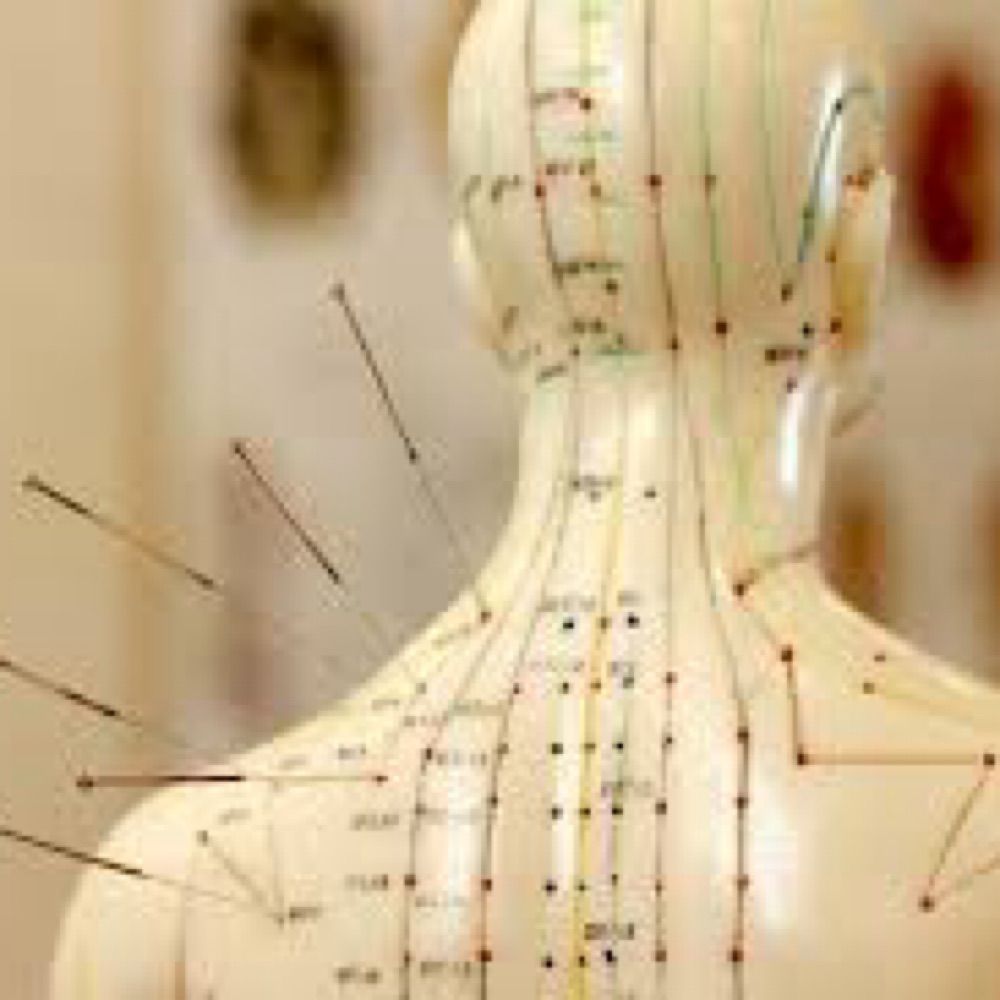The Acupuncture Doc