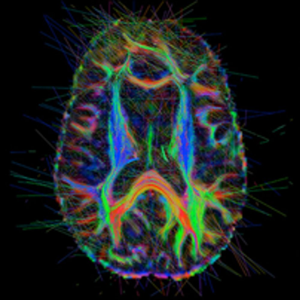UTDNeurolab