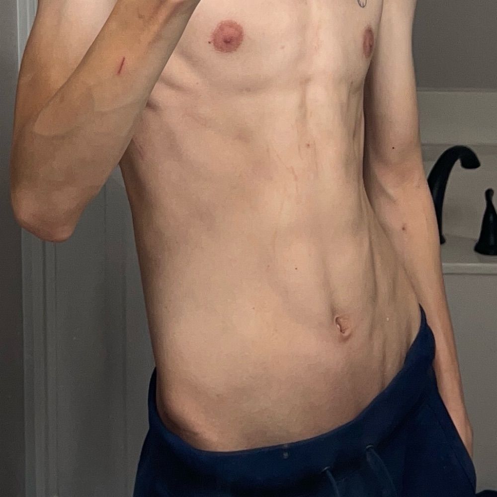 crusty twink