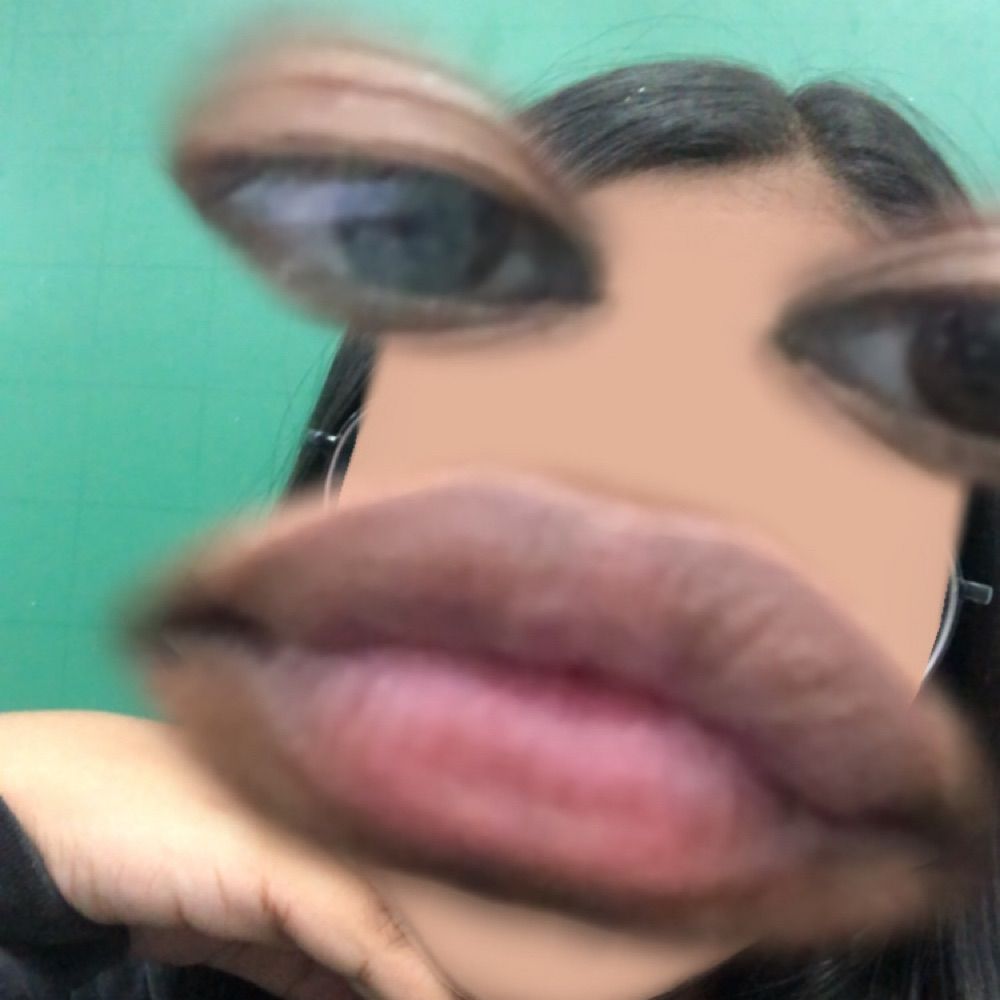 yas