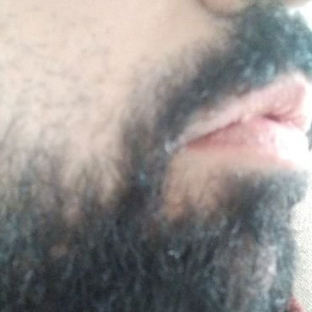 Beard87