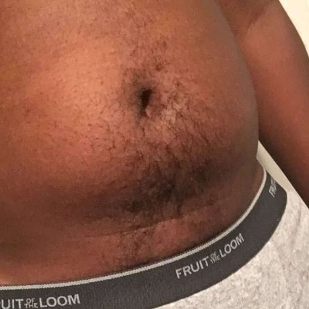 MVX
