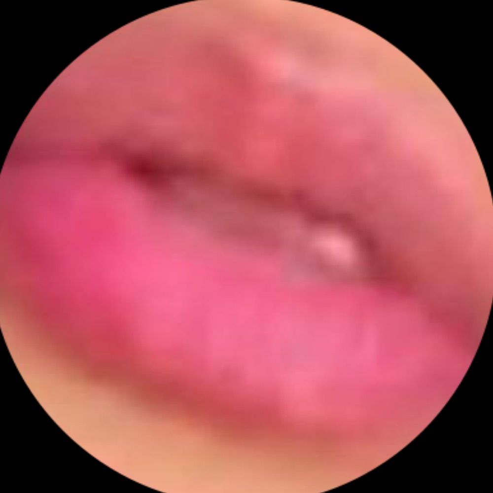 @medlisxx.bsky.social