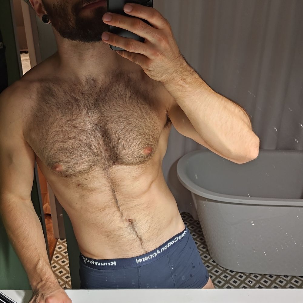 Arytmic