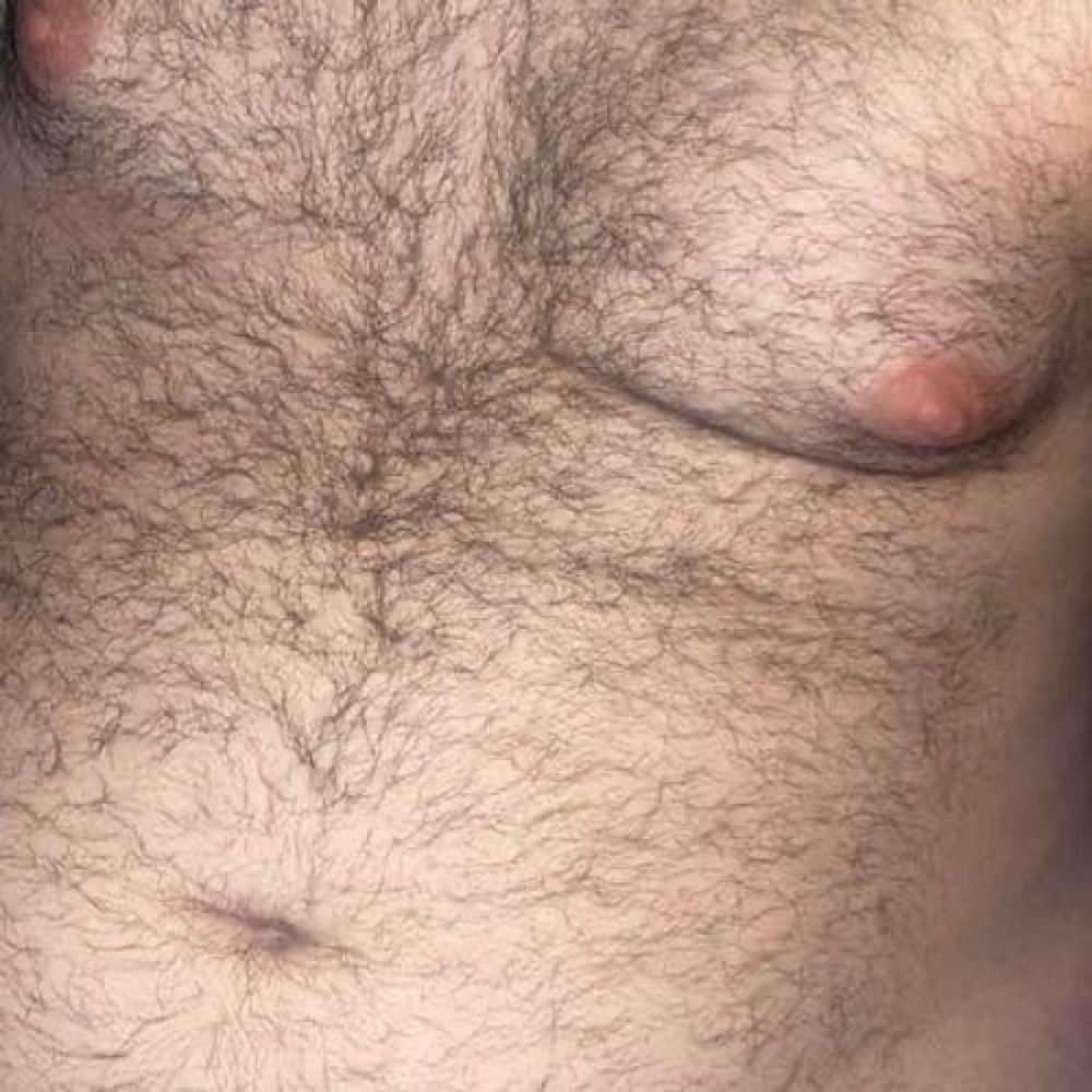 Hairy chub