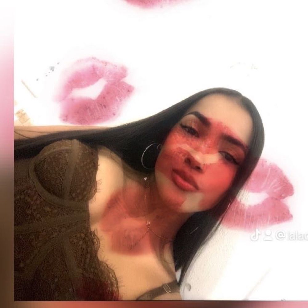 lala🍒