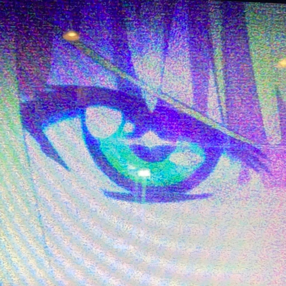 ひじ