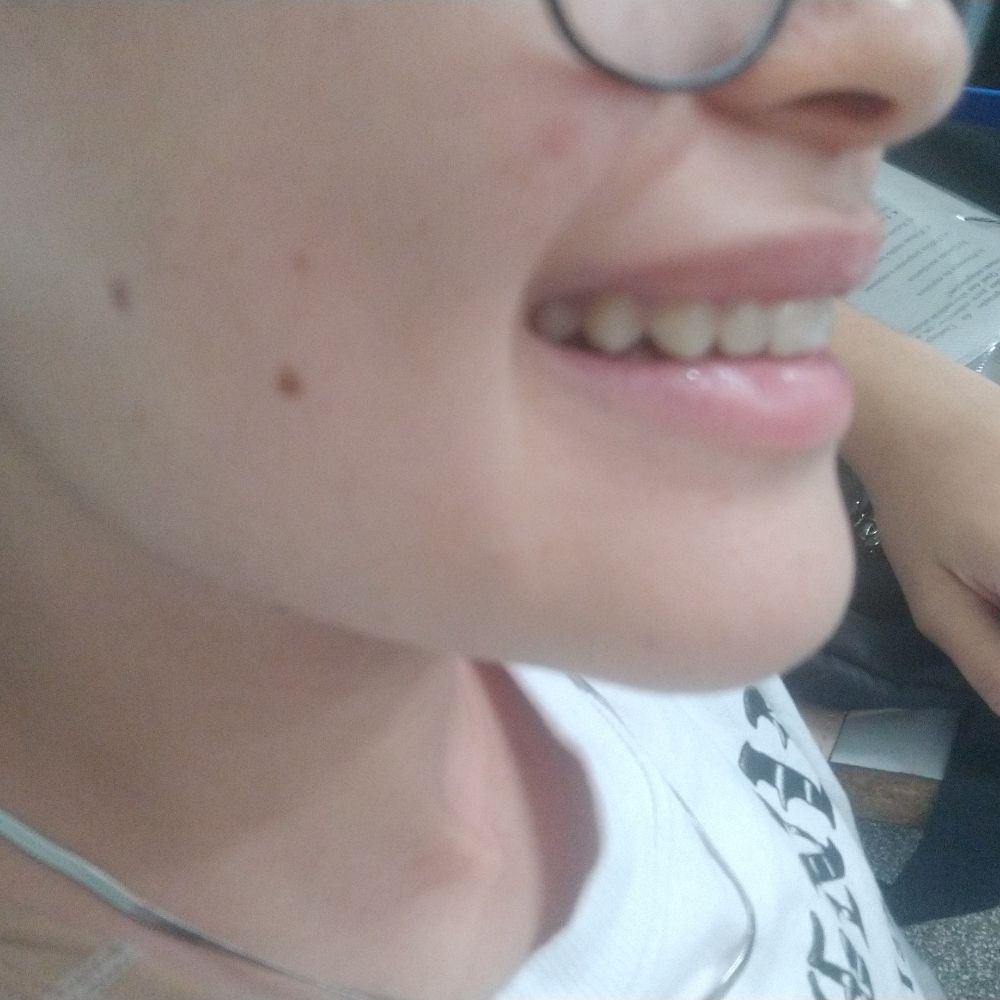 ket