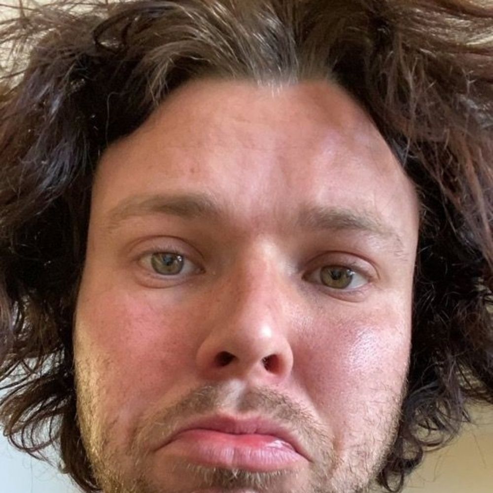 acervo ashton irwin