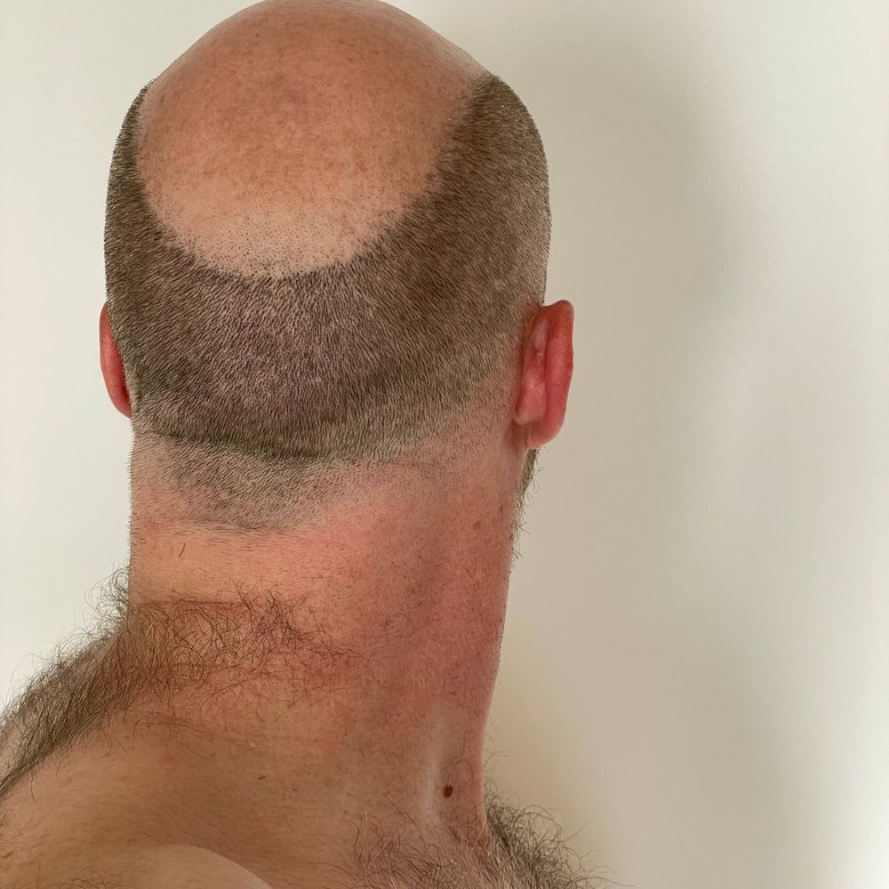 GOBALD.ME
