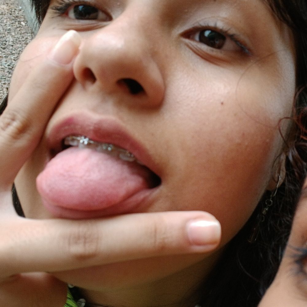 lolla
