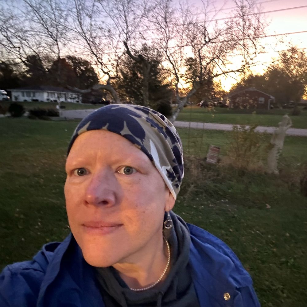 Amy Beumer