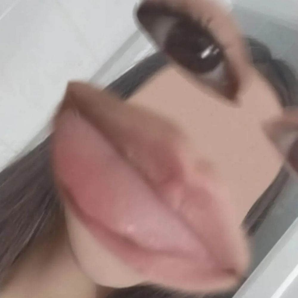 soso