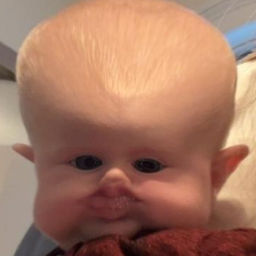 MM