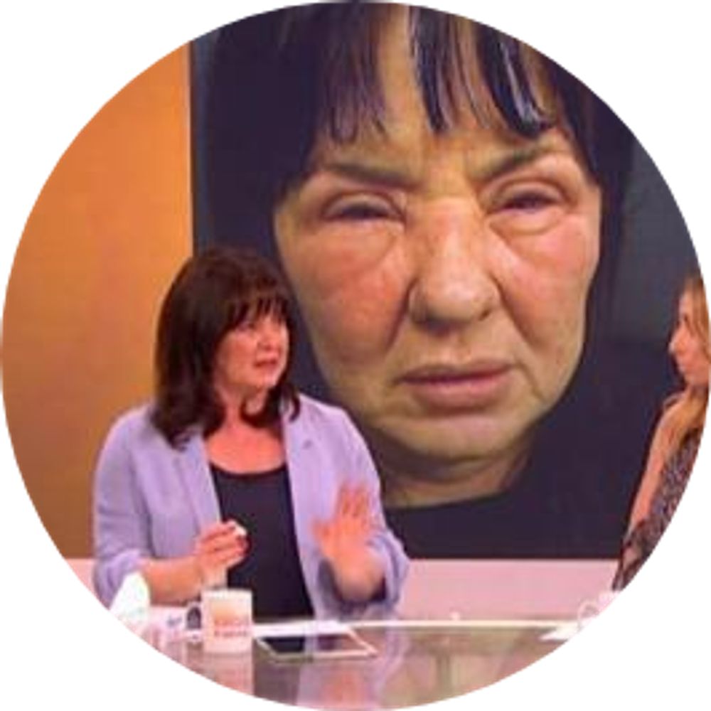 Coleen Nolan