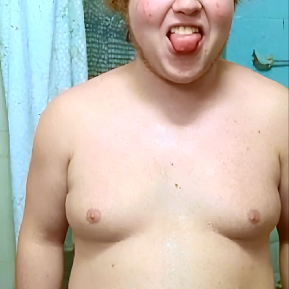 IGotRancidFartz