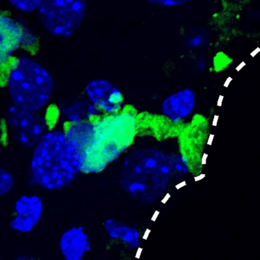 Neurogenesis and Brain Tumors Laboratory - Mayo Clinic