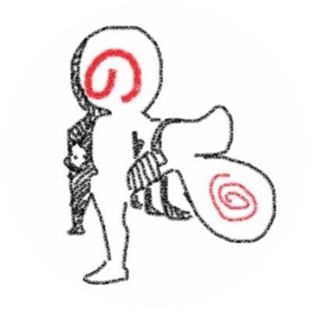 ノイズ
