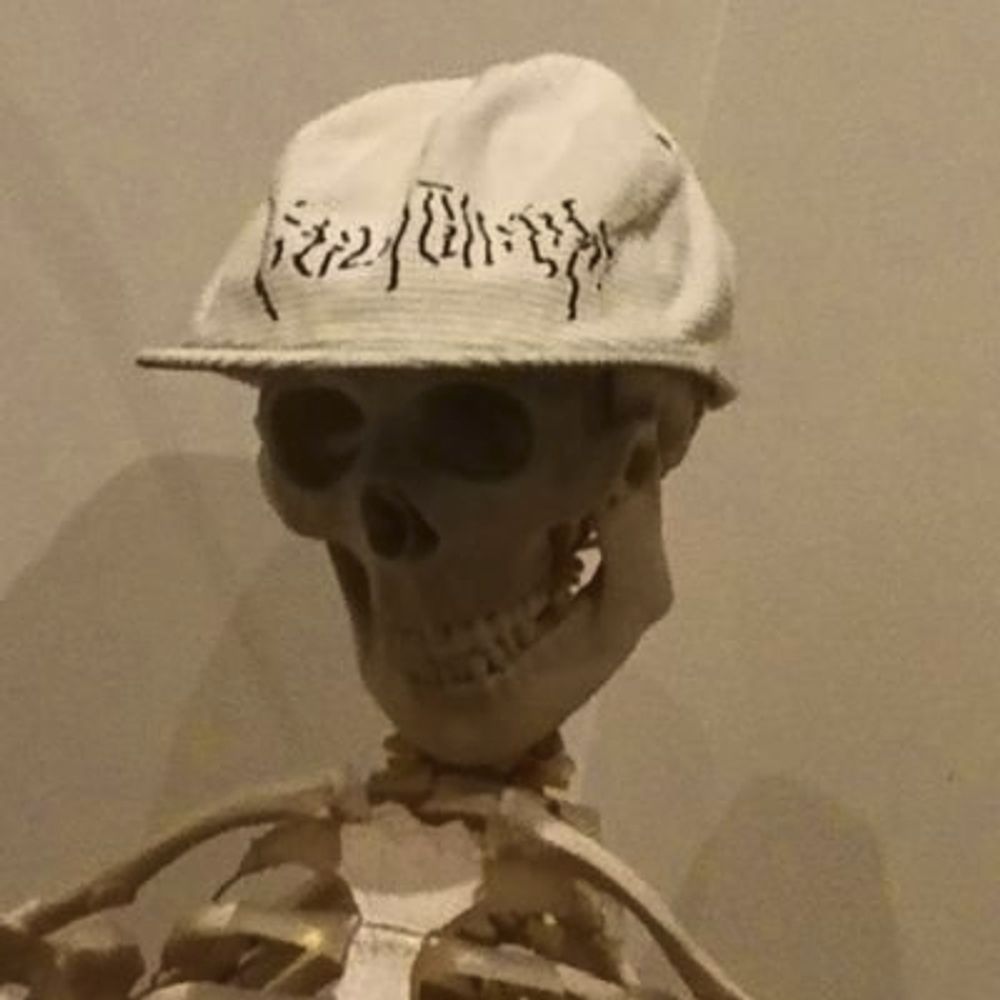 DΔX
