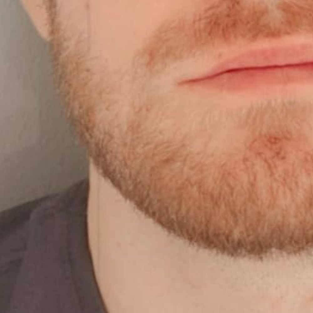 Red Beard 