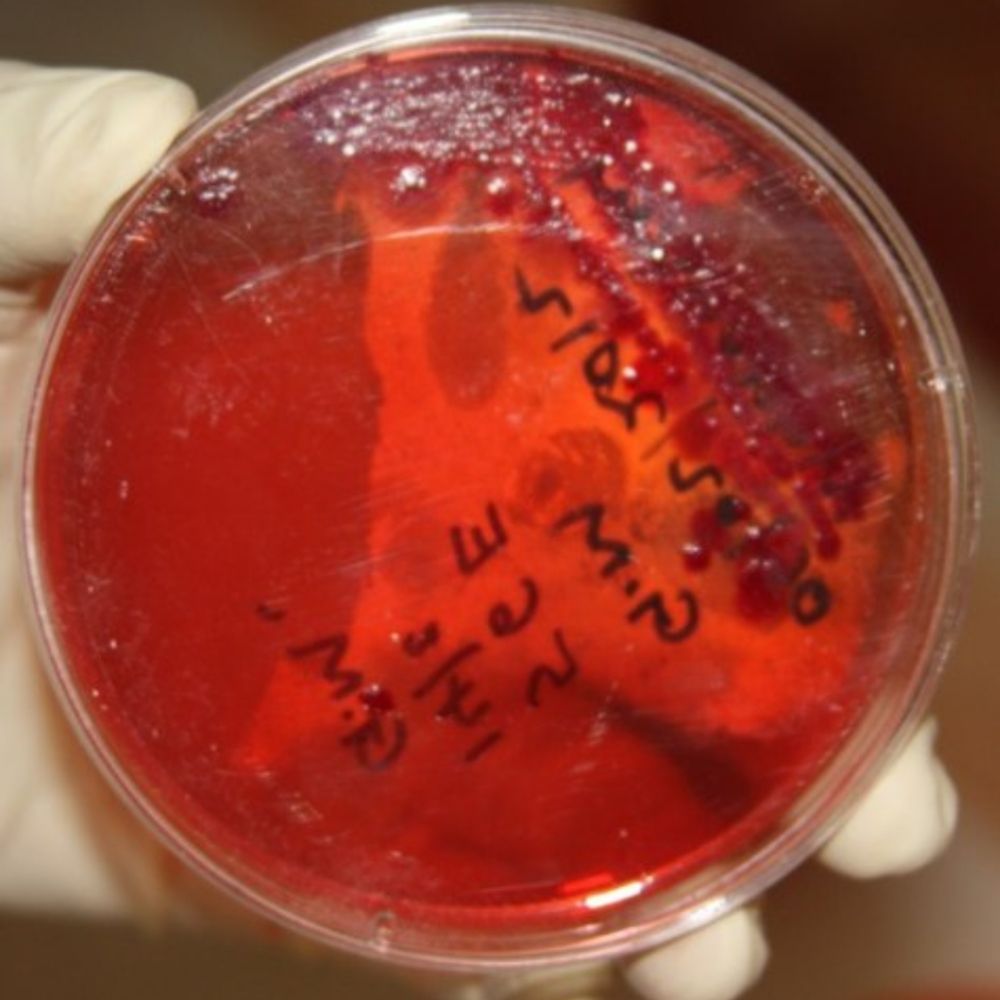 zoonoticdisease