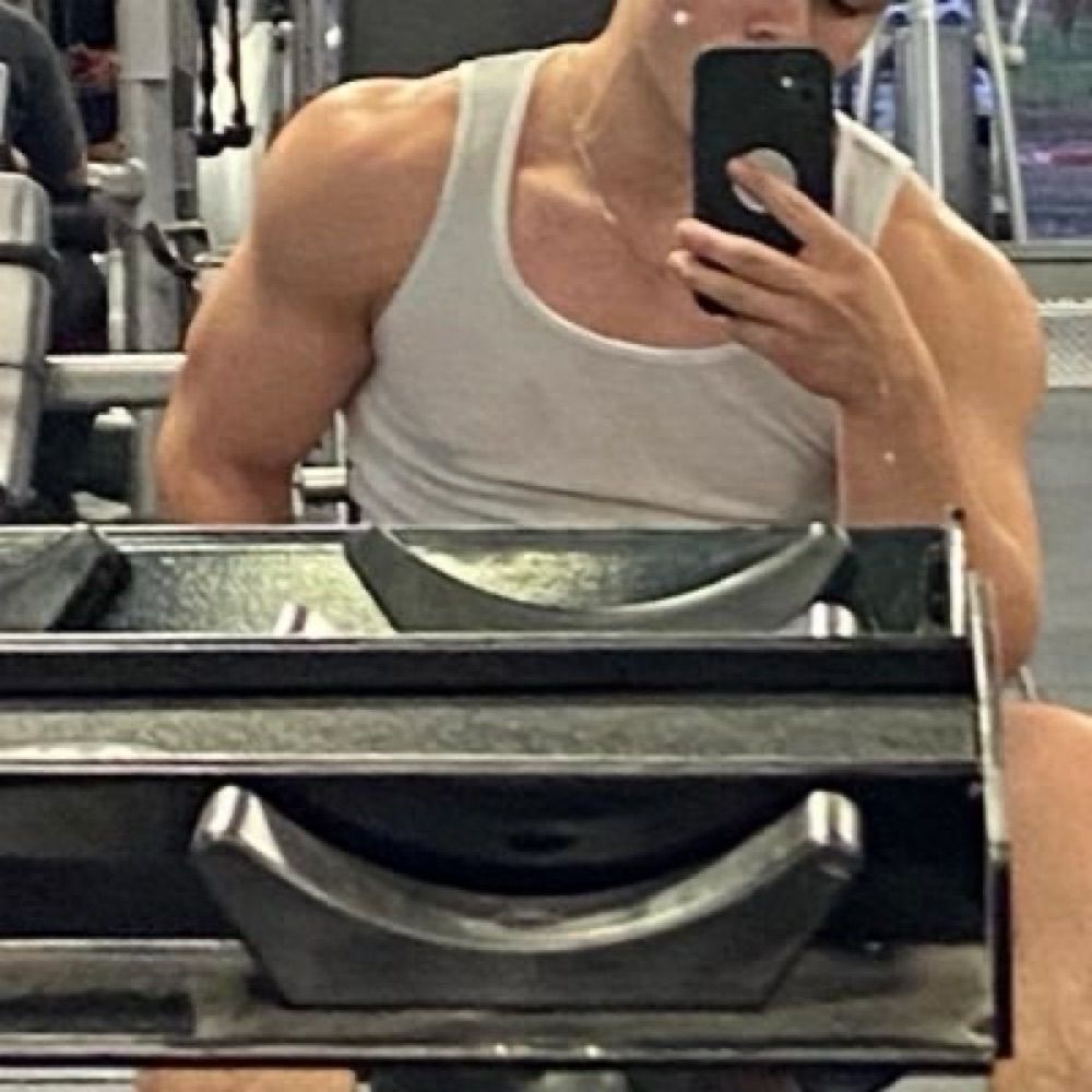 Anthony Garcia 💎