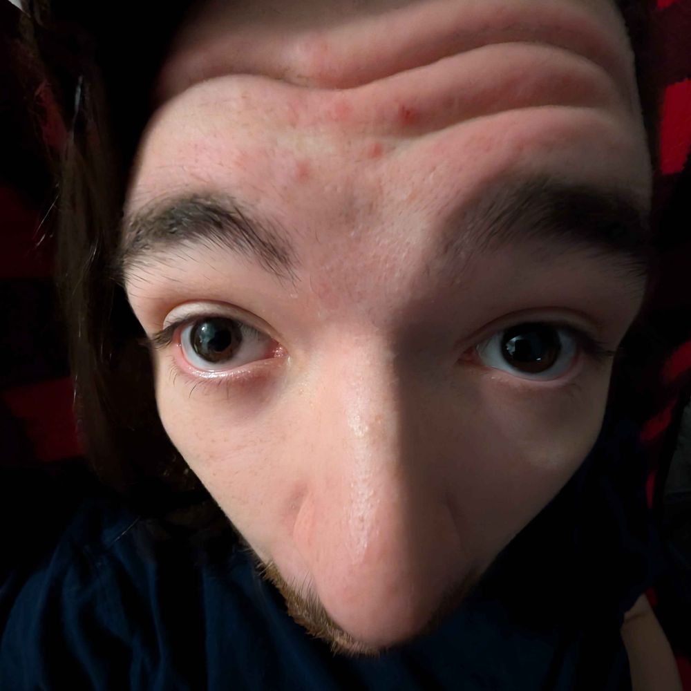 Jakobmeathead