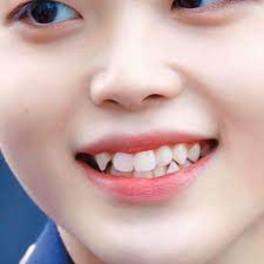 dentinho torto do hyeongjun 
