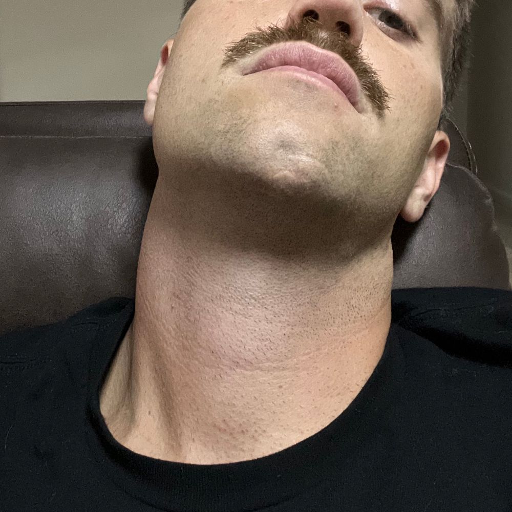 dc throat (Ptown Aug 9-16)