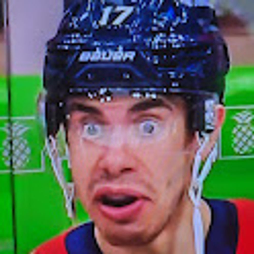 x - Evan Rodrigues' Goofy Ass Face