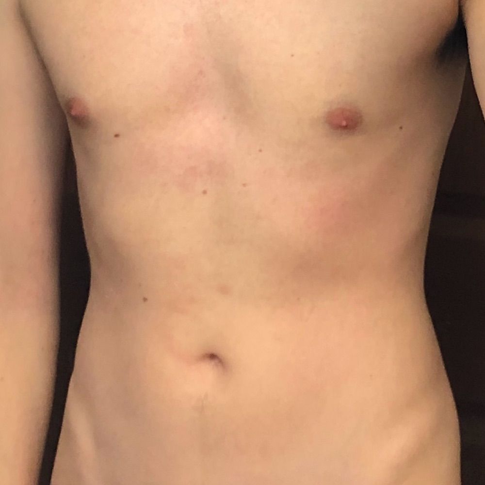 Erstwhile Twink