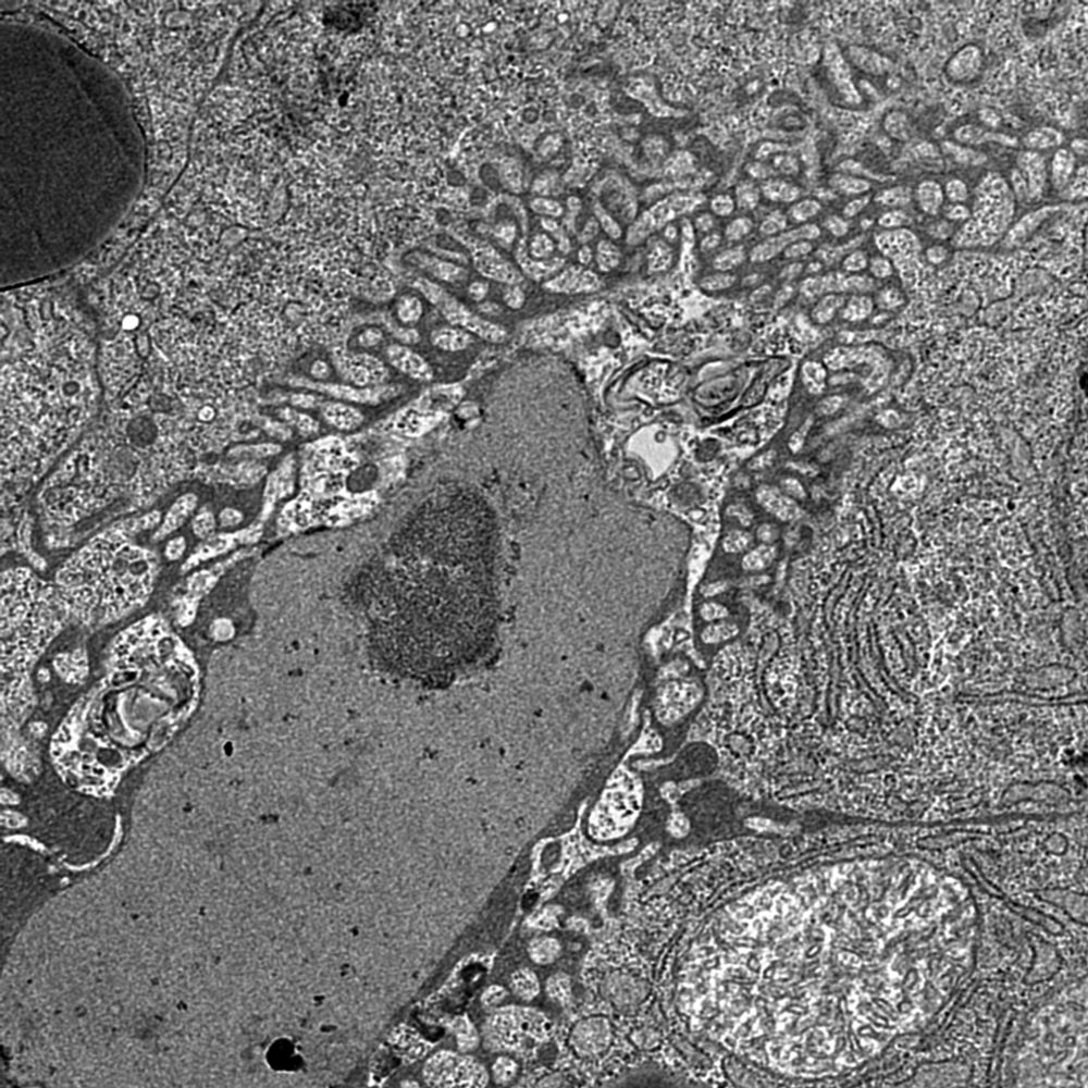 Biological Electron Microscopy