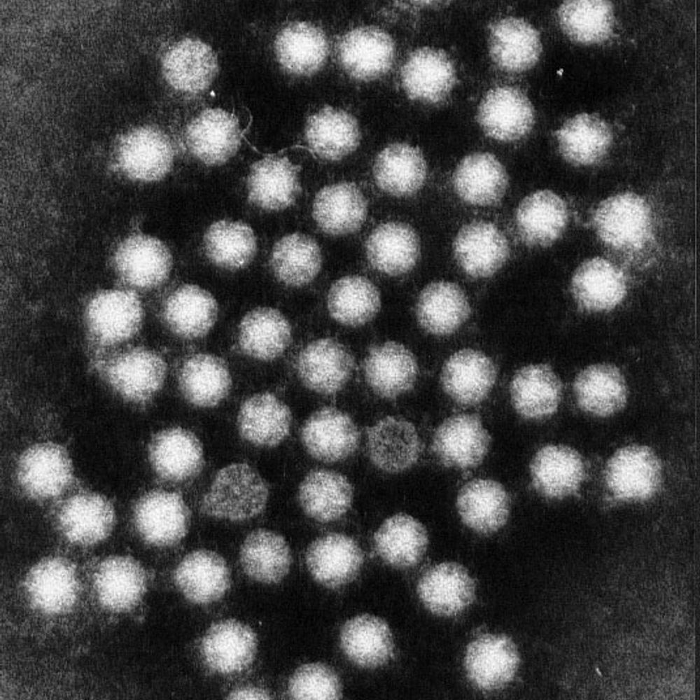 Virus Entèrics UB