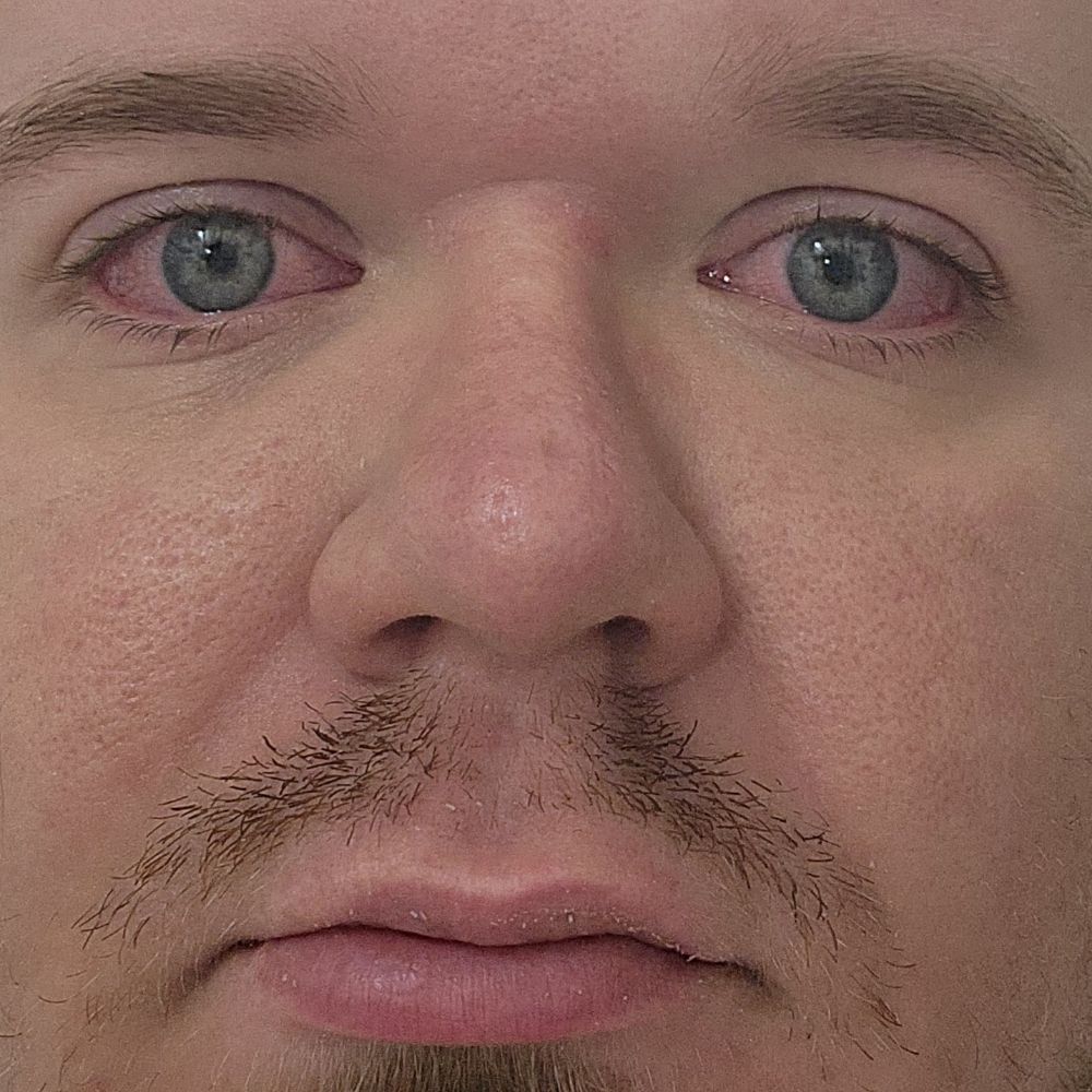 ChronicAndKrunk