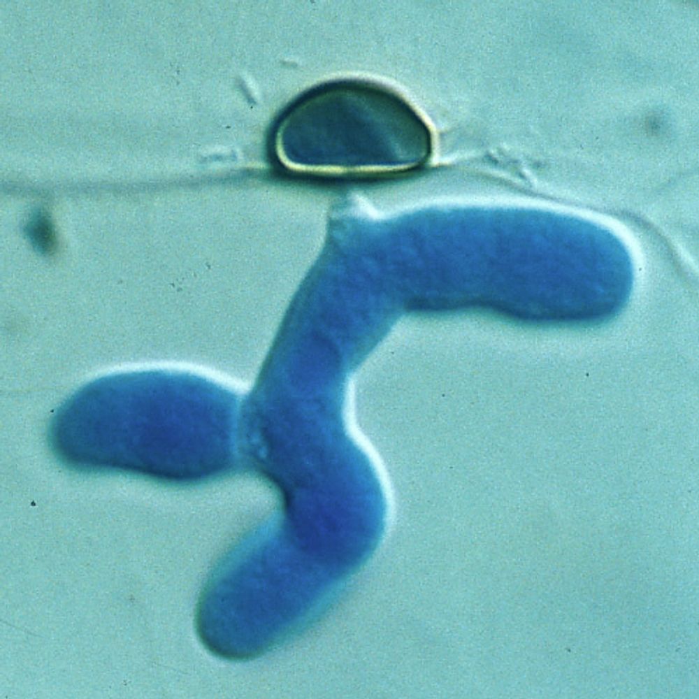 Communication at the Fungal-Plant interface