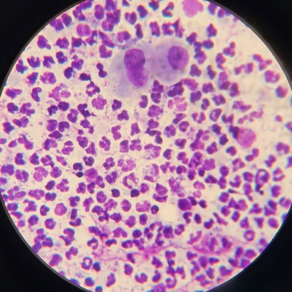 Microsporum