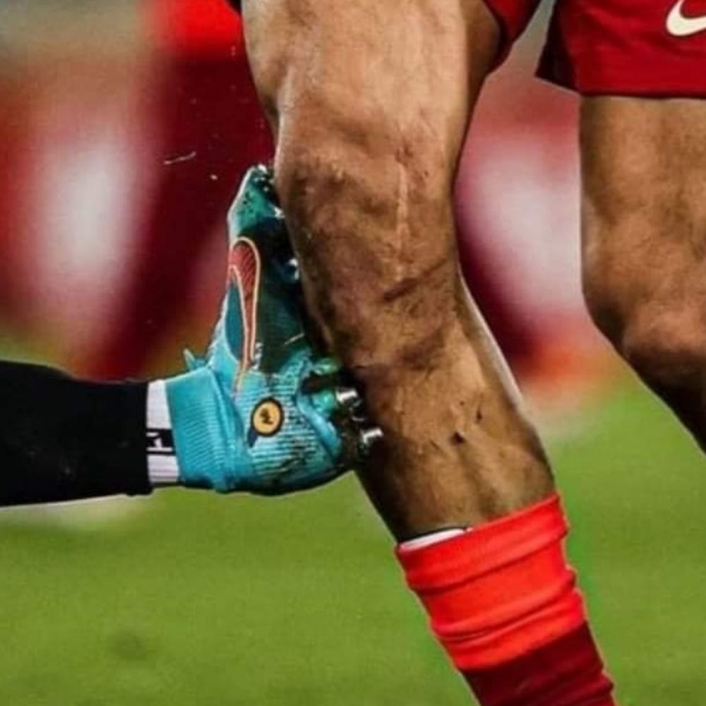 Premier League Injury Updates.