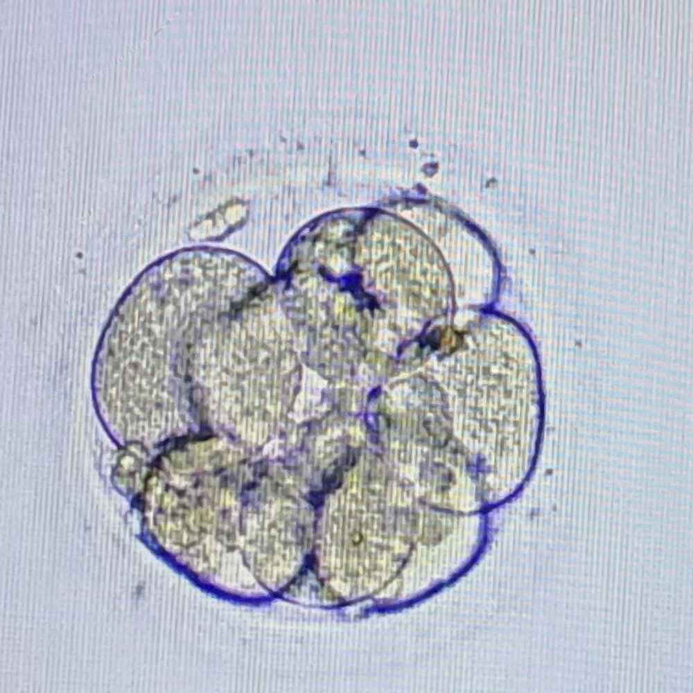 Embryology