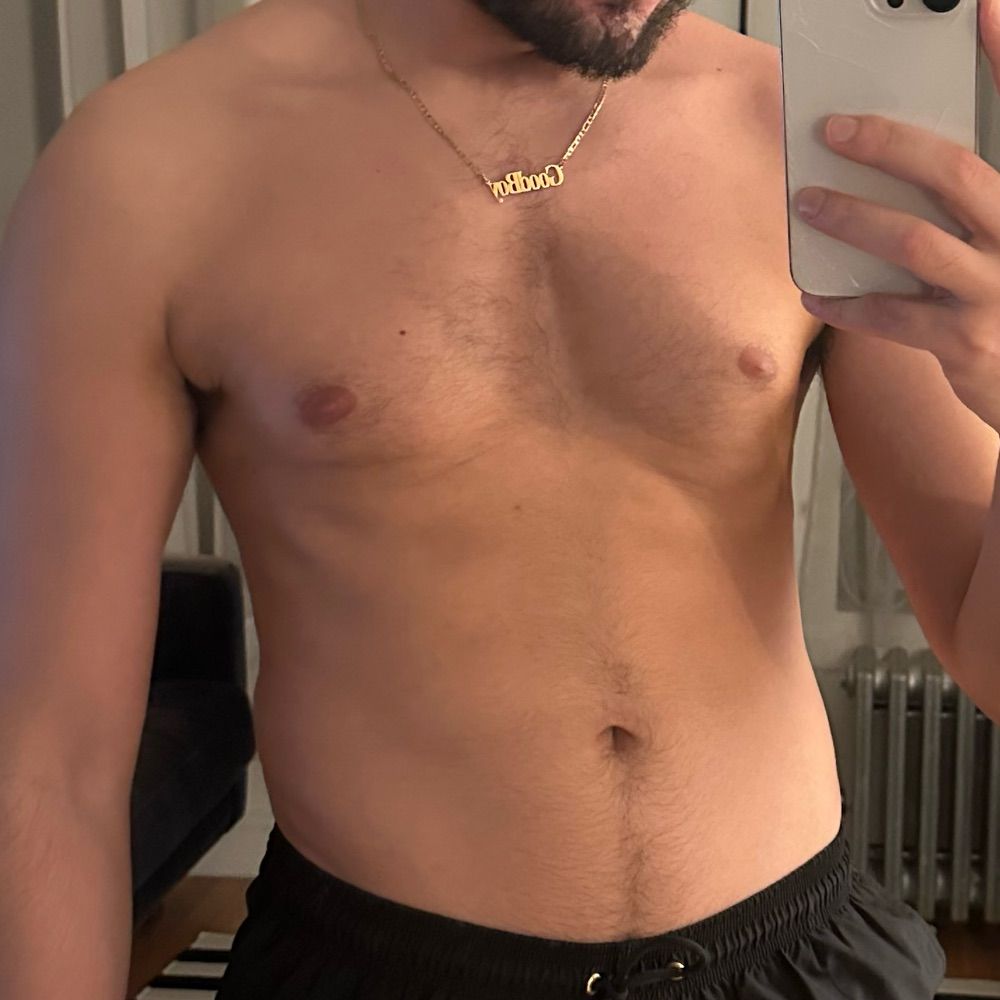RD