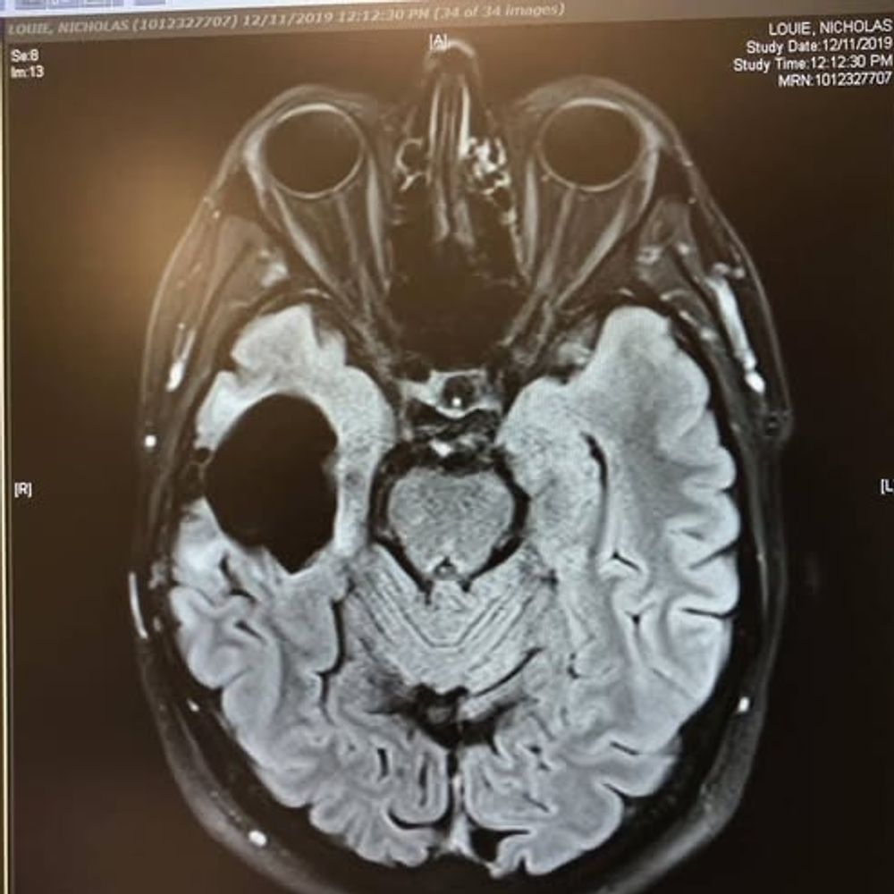 agnolotti.bsky.social