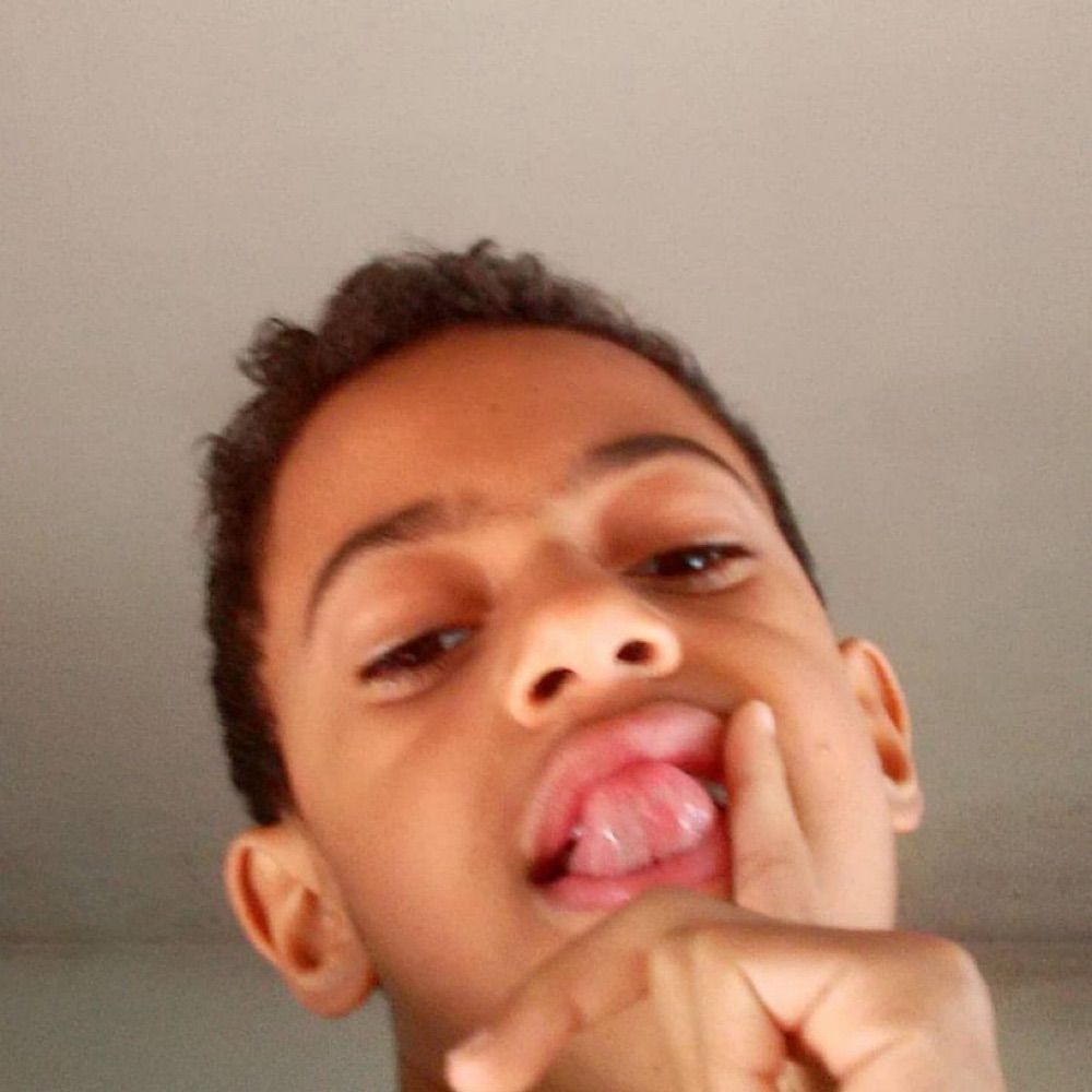 Fernandes ᶜᵃᵐ