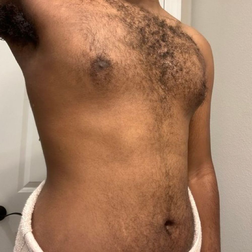 Furry