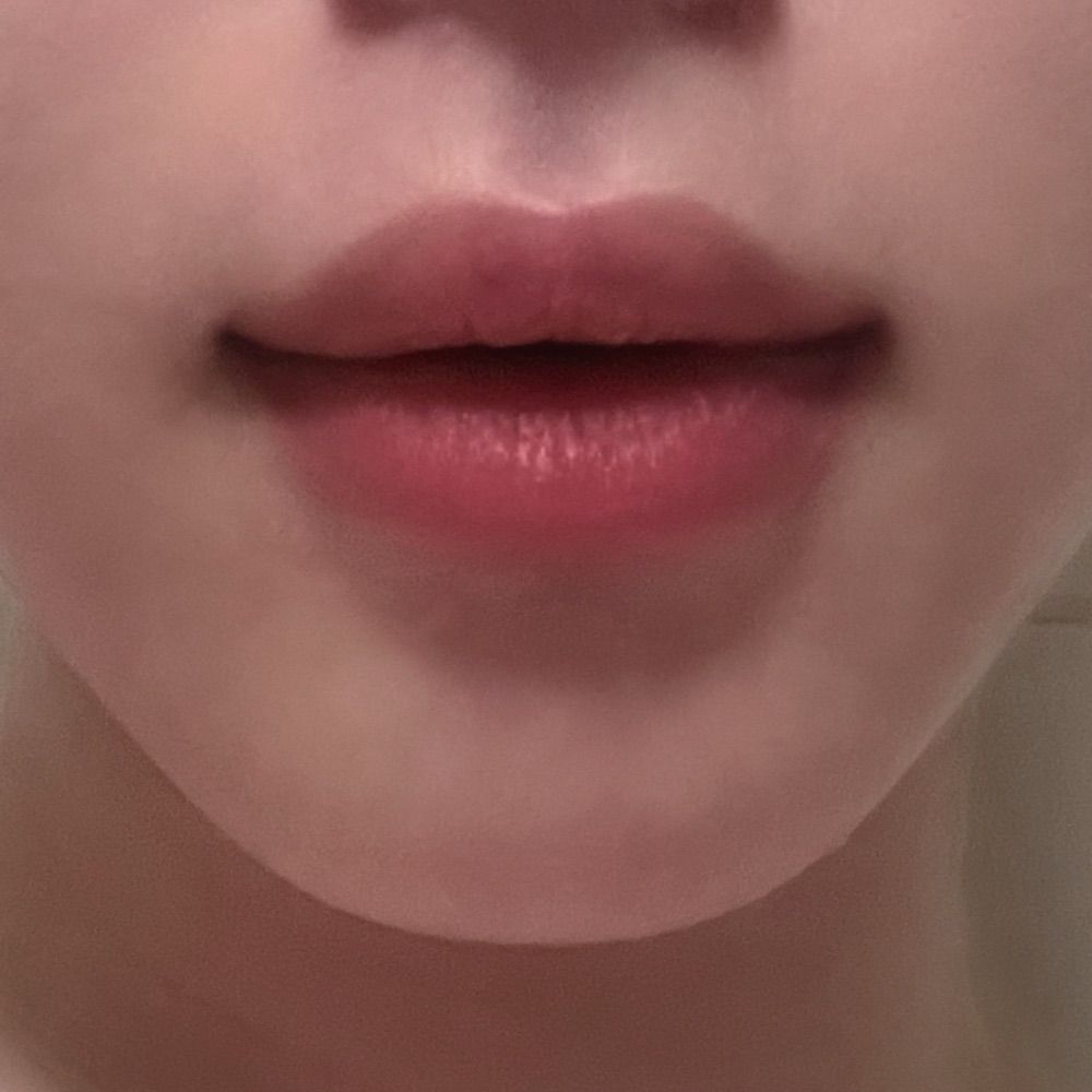 𝐗𝐍