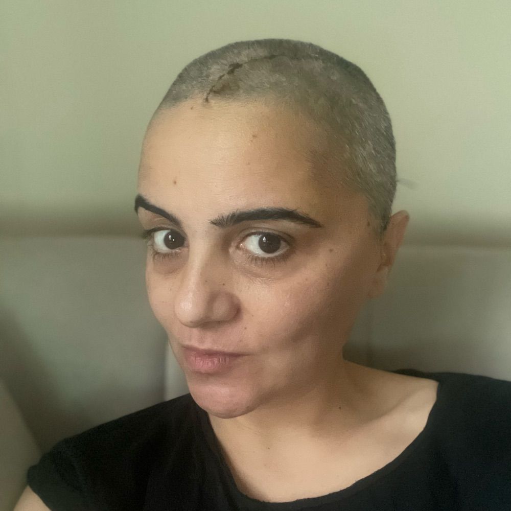 Eda Özer