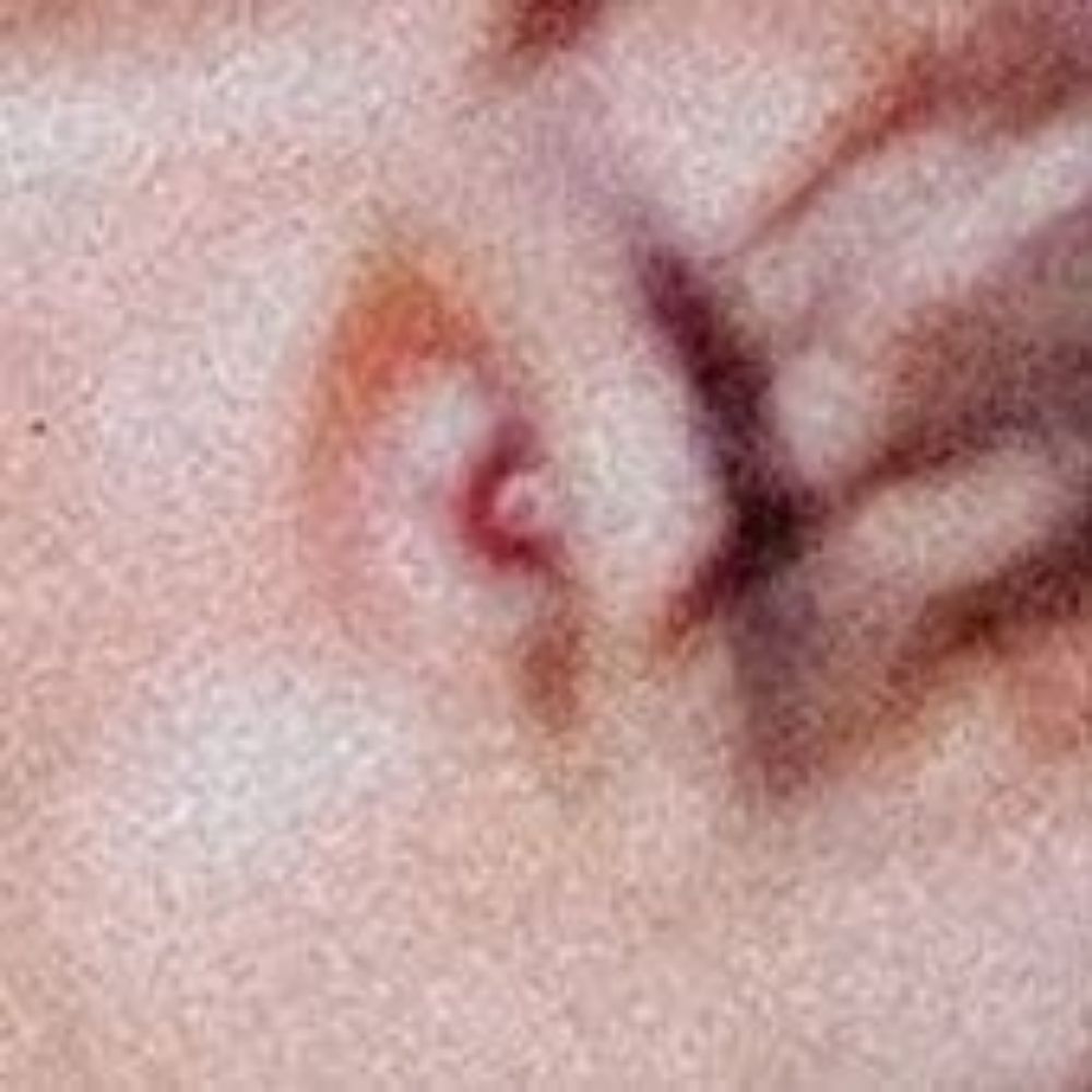 Draxxtênio