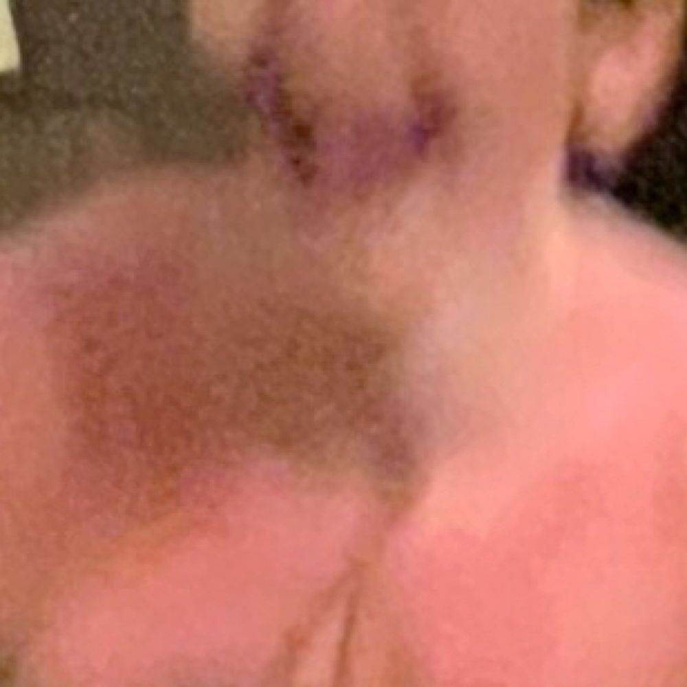 DFed