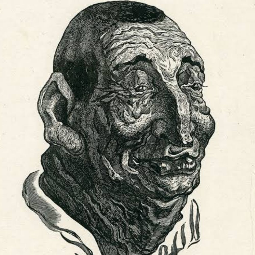 Fedor