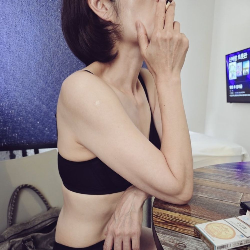 안질리나,피트부부