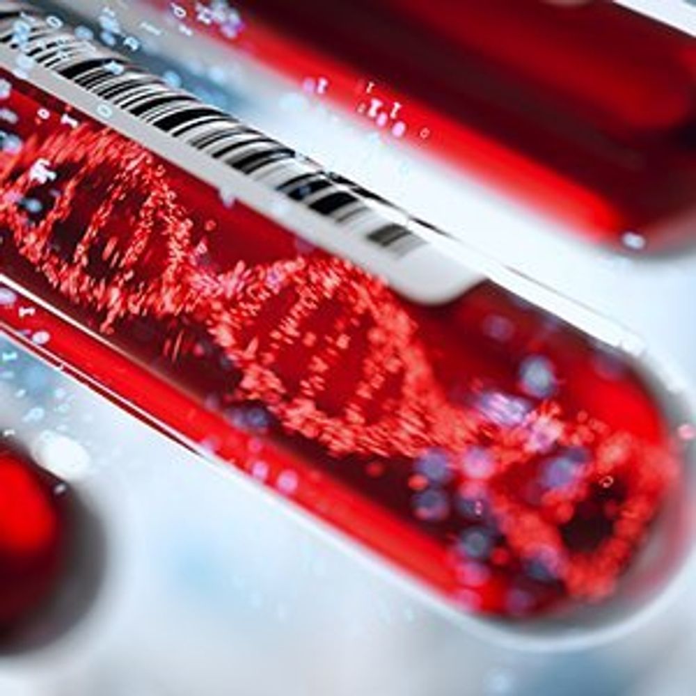 Thomas Ashworth CTC and Liquid Biopsy Symposium