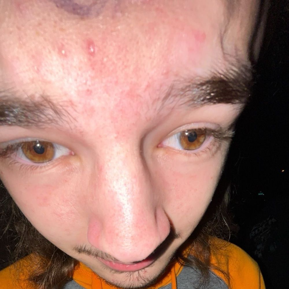 Everett